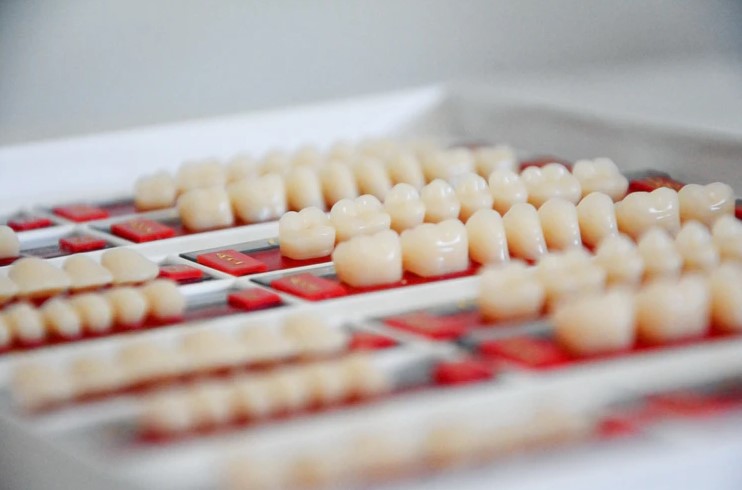 Benefits of Teeth Straightening