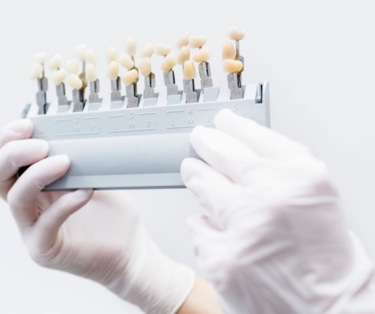 Dental Veneers before and after