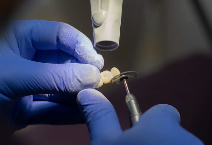 Partial Dentures cost at private clinic