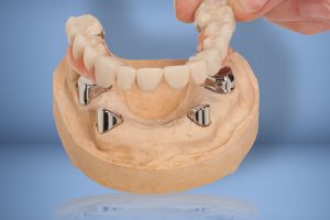 Corby Dentist Leicester Dentist Best Denture