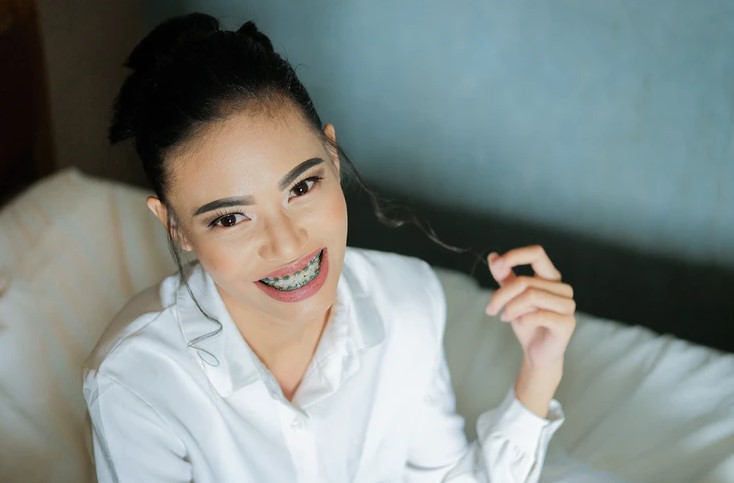 Why Invisalign Is Better than Braces