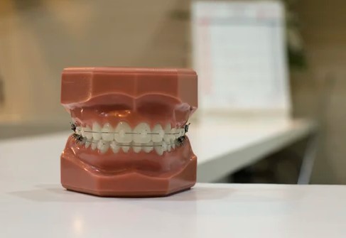 Why Invisalign Is Better