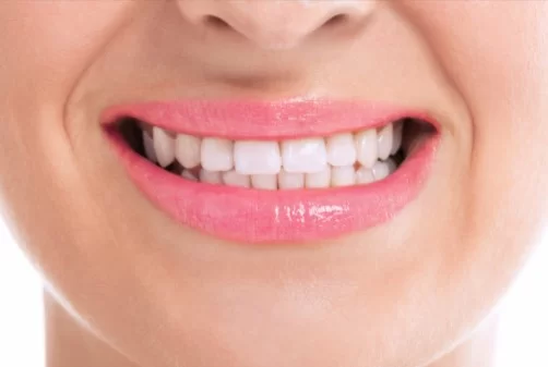 Enlighten teeth whitening