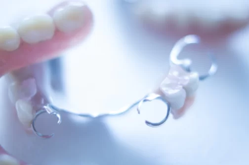 What is a partial denture