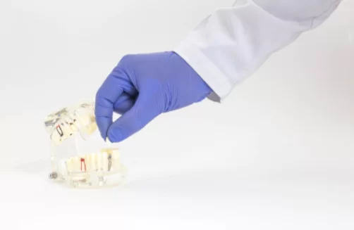 Benefits of Lumineers