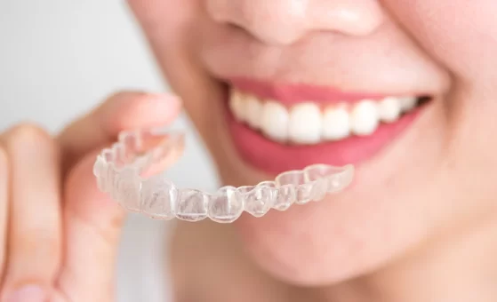 Six Month Smiles Vs Invisalign