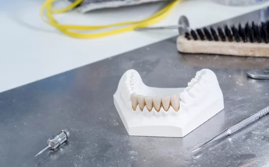 What is the procedure for Zirconia Veneers