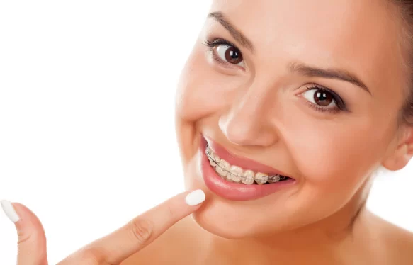 Advantages of Clear Braces