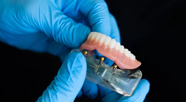 Taking Care of Full set Dentures