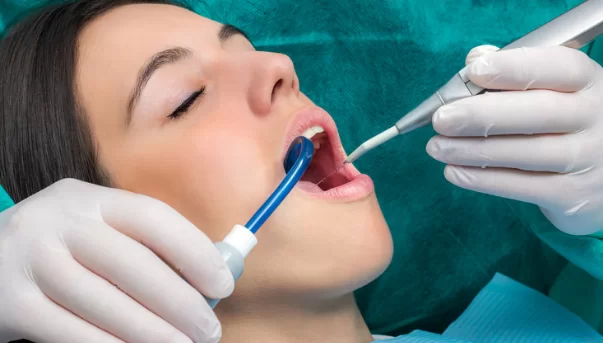 Pros of Composite Bonding