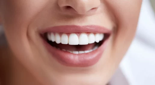 Are you getting what you paid for