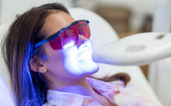 Teeth Whitening at Dentist Vs Home