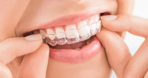 Invisalign is Invisible