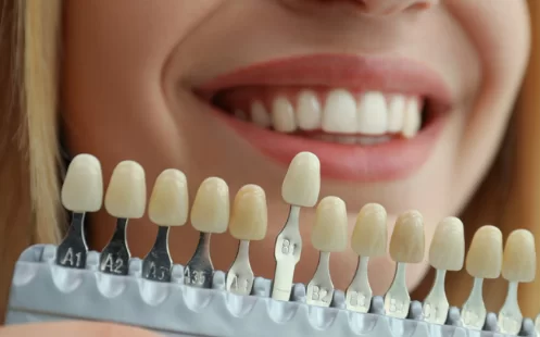 Types of Cosmetic Dentistry