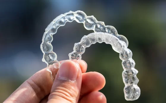 What Is Invisalign
