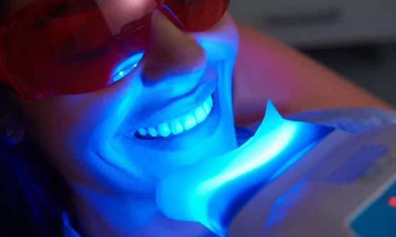 Teeth Whitening