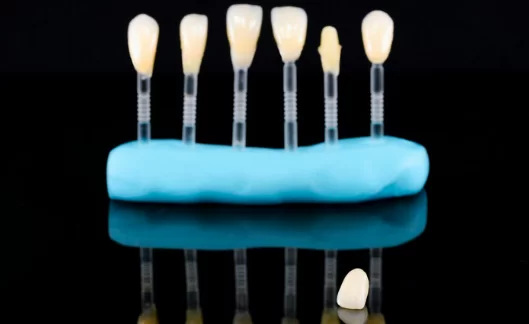 Can Porcelain Veneers Crack With Time