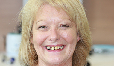 Before - Natural Smiles Implant & Cosmetic Dentistry