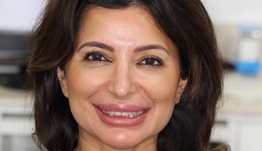 Before - Natural Smiles Implant & Cosmetic Dentistry