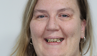 Before - Natural Smiles Implant & Cosmetic Dentistry