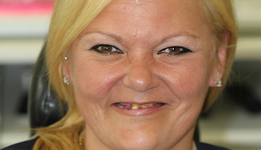 Before - Natural Smiles Implant & Cosmetic Dentistry