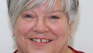 Before - Natural Smiles Implant & Cosmetic Dentistry