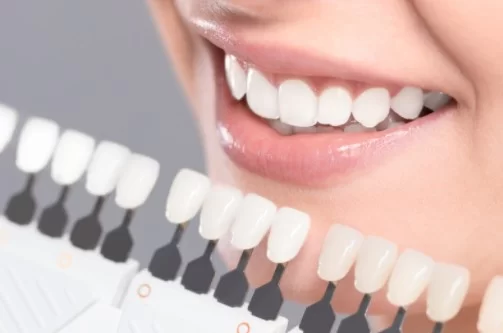 Centre of Excellence for Teeth Whitening