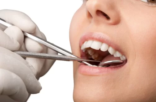 What Is Cosmetic Bonding & How Much Does It Cost in the UK