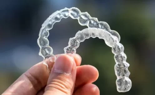 What is Invisalign