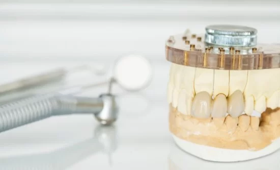dental crown lifetime