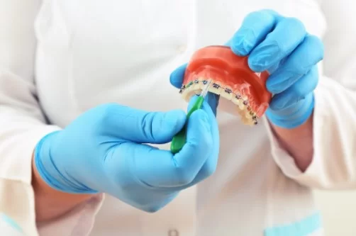 what is invisalign