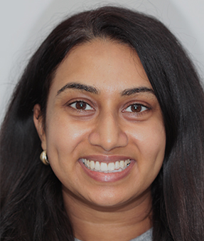 Treatment - Natural Smiles Implant & Cosmetic Dentistry