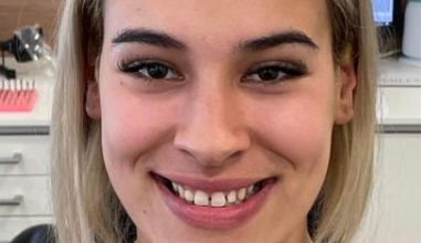 Before - Natural Smiles Implant & Cosmetic Dentistry