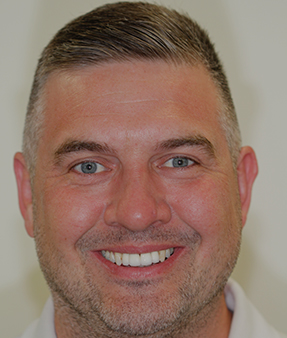 Treatment - Natural Smiles Implant & Cosmetic Dentistry