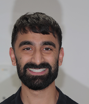 Treatment - Natural Smiles Implant & Cosmetic Dentistry